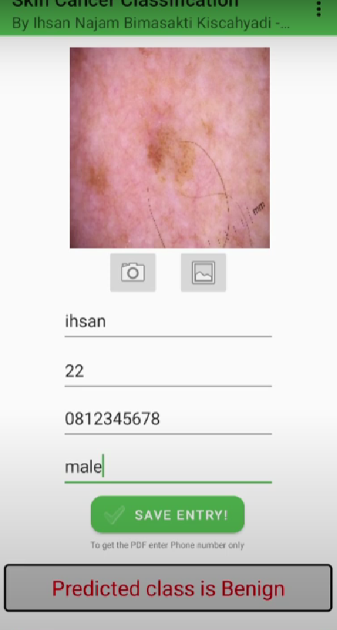 Skin Cancer Classification