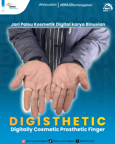 DigiSthetic: Inovasi Prostetik Jari Digital yang Estetis dan Fungsional